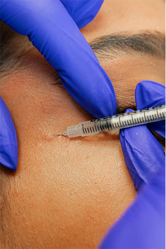 تزریق بوتاکس